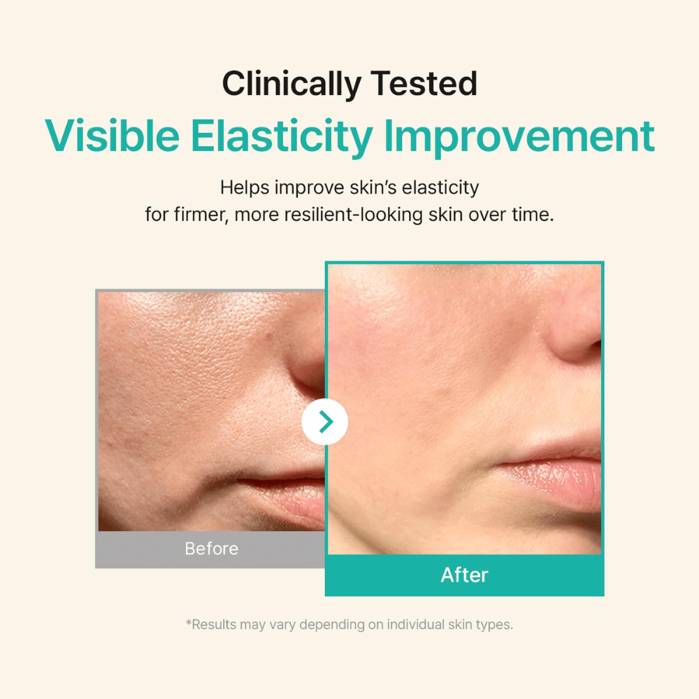Before-and-after image showing improved skin elasticity and firmer skin after using the serum.
