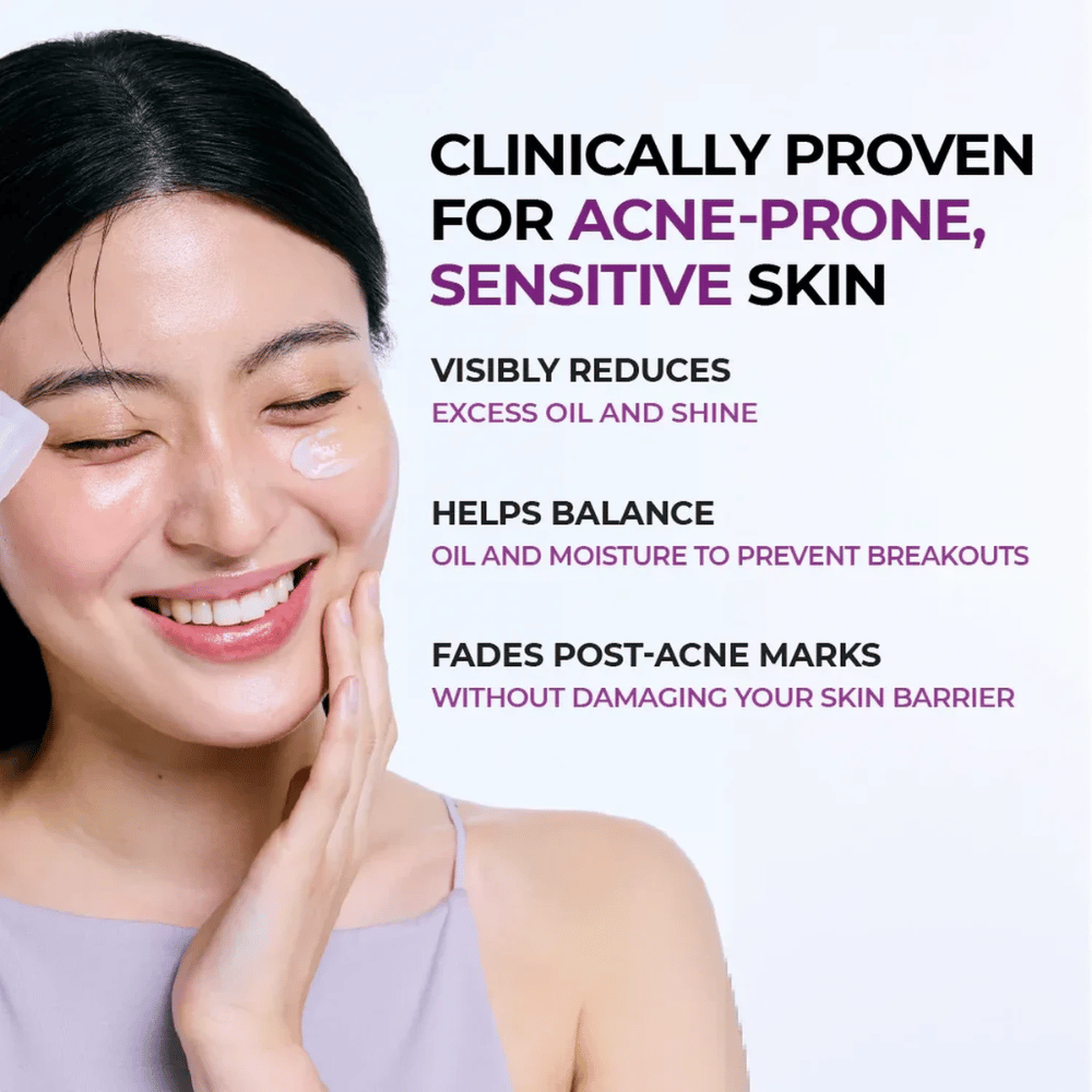 Model applying the cream to the cheek. The image highlights the product's clinically proven ability to reduce shine, balance the skin's oil and moisture levels, and reduce the visibility of post-acne marks.